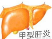 甲肝抗体,人体免疫防线与疾病防控的关键指标